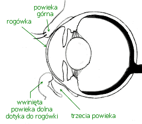 entropium